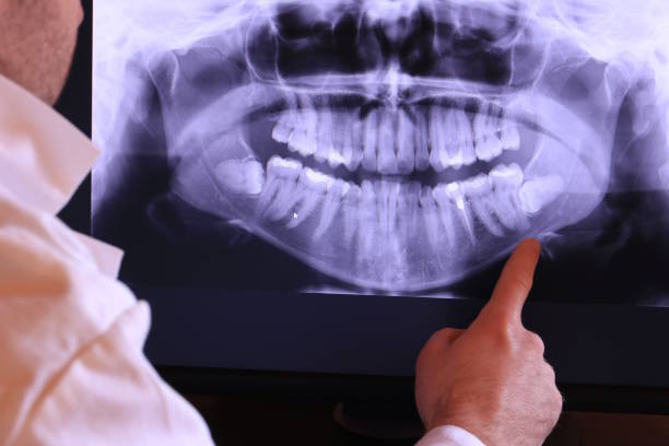 Dentist for Dental Trauma in OH