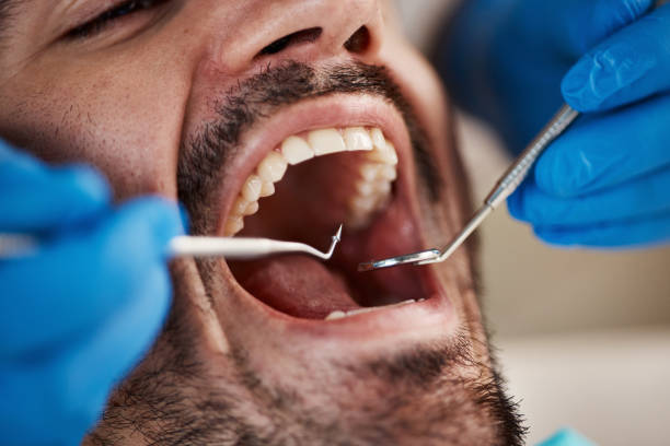Best Urgent Tooth Repair  in Minerva, OH
