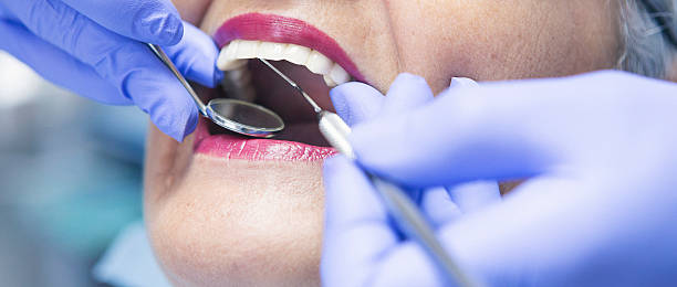 Best Teeth Whitening  in Minerva, OH