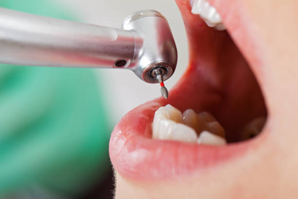 Best Root Canal Emergency Dentist  in Minerva, OH